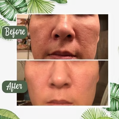 🍵 Deep Cleanse Green Tea Mask