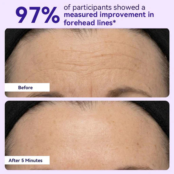 🔥Limited Time Offer🔥Instant Lift Eye Gel- Reduce the Look of Eye Bags in Minutes