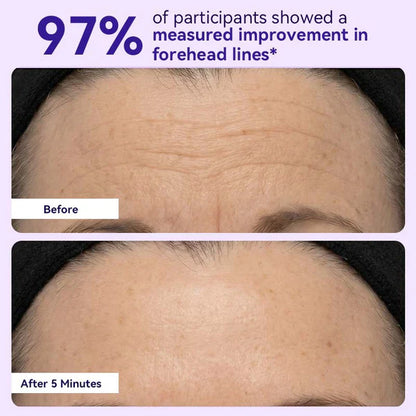 🔥Limited Time Offer🔥Instant Lift Eye Gel- Reduce the Look of Eye Bags in Minutes