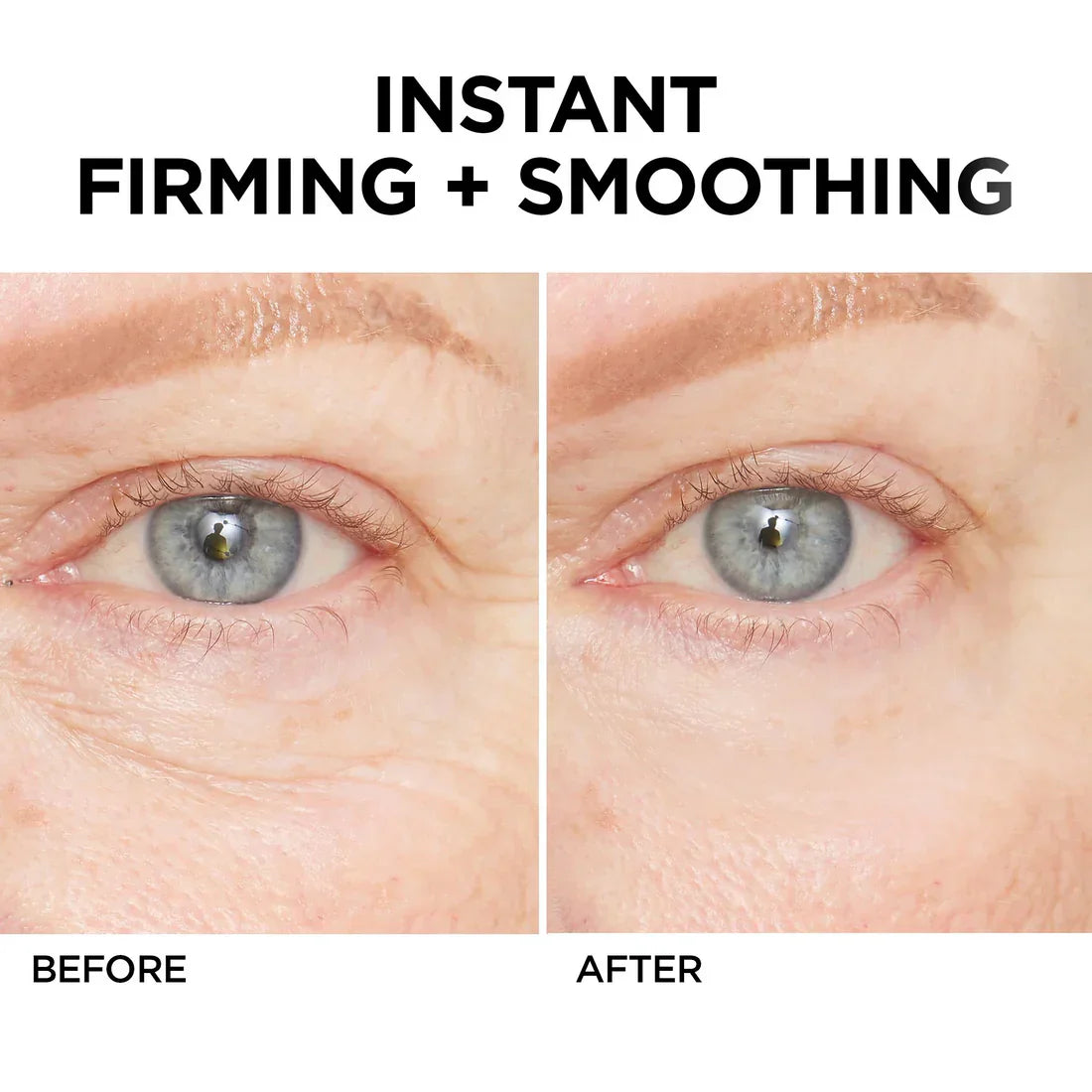 🚨𝑳𝑨𝑺𝑻 𝑫𝑨𝒀 𝑫𝑰𝑺𝑪𝑶𝑼𝑵𝑻: 𝟖𝟕% 𝑶𝑭𝑭 🔥 Instant Wrinkle Eye Tightener Cream