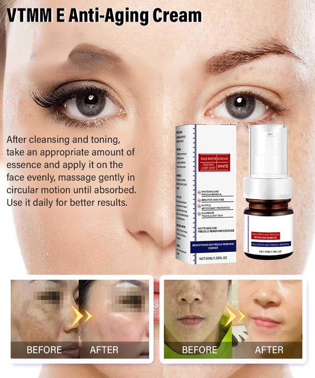 🔥Buy more save more🔥Freckle-Banishing Serum for Face: Repair and Cleanse Dark Spots