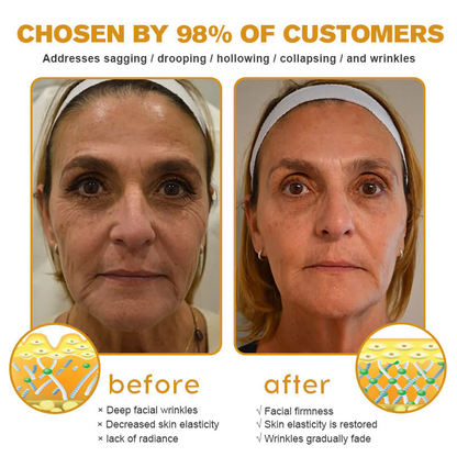 👨‍⚕️ Made and Shipped from US✅  Tlopa® Bee Venom Multi-Symptom Skin Treatment Cream