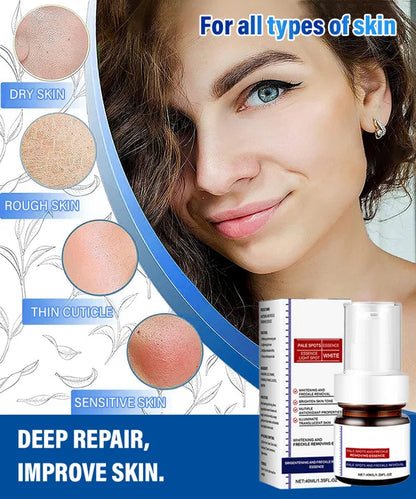 🔥Buy more save more🔥Freckle-Banishing Serum for Face: Repair and Cleanse Dark Spots
