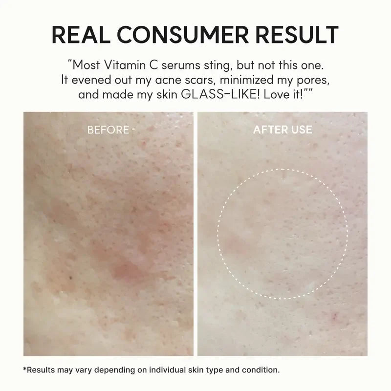 "Skin-Renewing" Dual-Action Duo — A pairing of Vitamin C and retinal that works synergistically day and night to brighten the complexion, refine pores, deeply hydrate, and fade dark spots.