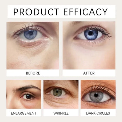 The Instant Eye Lift That Doesn't Betray You When You Smile