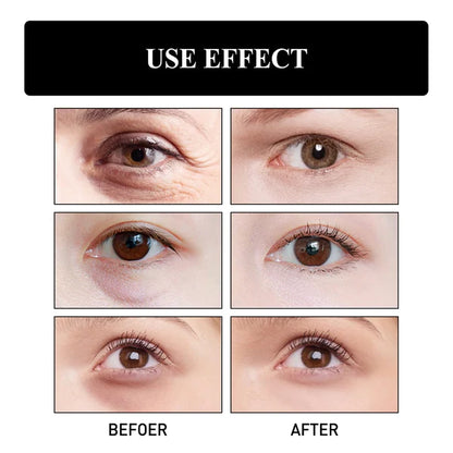 Collagen Boost Anti-Aging Serum🔥Refund immediately if there is no effect after use!