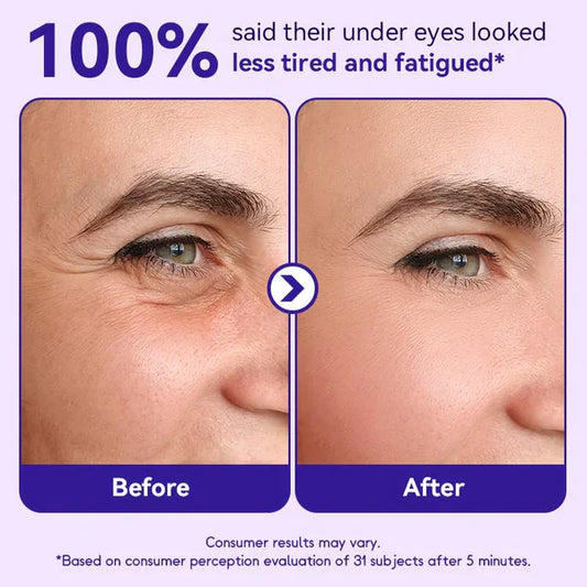 🔥Limited Time Offer🔥Instant Lift Eye Gel- Reduce the Look of Eye Bags in Minutes