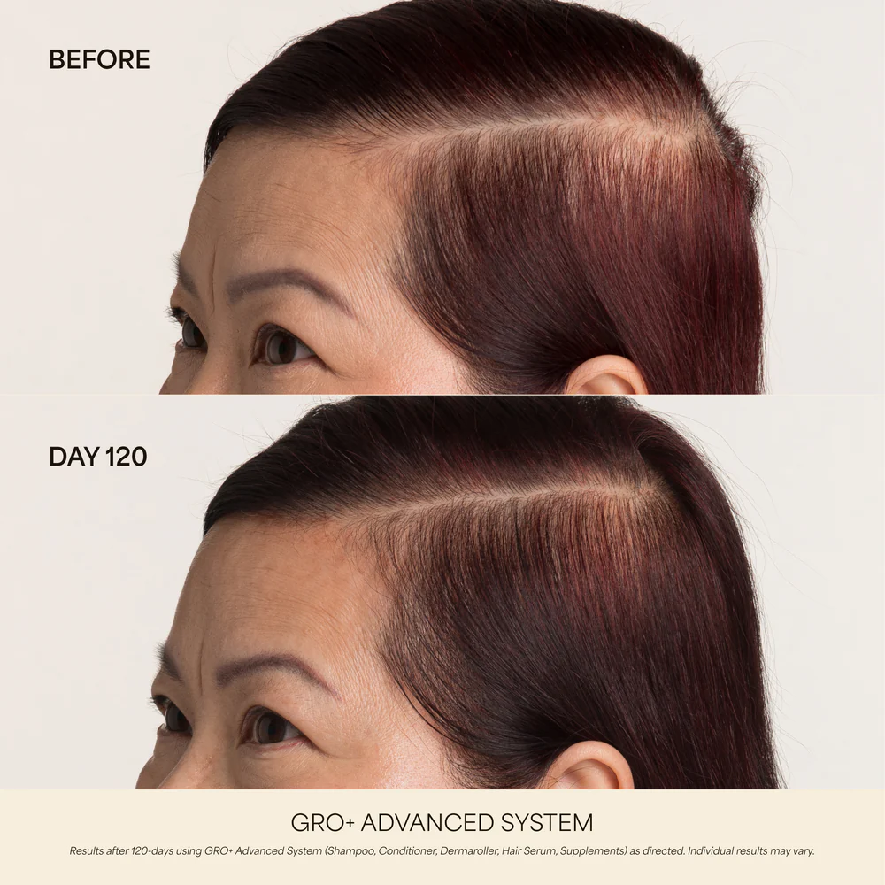 Hair Growth & Longevity Kit